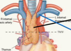 Thymus (in children)
SVC and brachiocephalic veins
Aortic arch and branches
Nerves (vagus and phrenic)
Trachea
Esophagus
