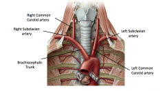The Right Common Carotid Artery and the Right Subclavian artery
