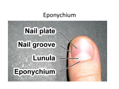 The stratum corneum layer of skin covering the nerve root. aka the cuticle