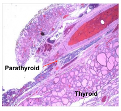Normal thyroid and parathyroid