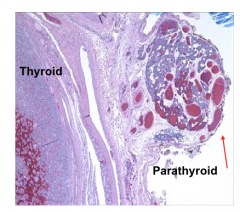 Normal thyroid and parathyroid