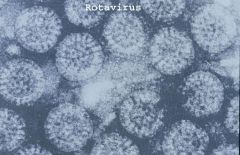 •RNA virus, the most common cause of infant diarrhoea
•Ubiquitous worldwide, 95% of children infected by 3 to 5 years of age
•Viruses survive at room temperature, treatment with detergents and acidic pH in a stomach
•Acute gastroenterit...