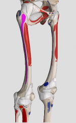 What muscles has its origin at the highlighted purple portion?