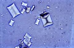 What kind of crystal is this and what could it indicate in a urine microscopic evaluation.