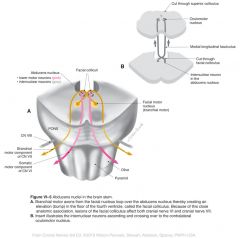 General somatic efferent: Supplies the lateral rectus of the eye.

Image 32
