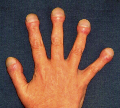 What underlying diseases could cause this sign?