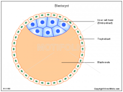blastocyst which consits of an inner cell mass and trophoblast