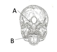 What is structure A on the occipital bone? 
