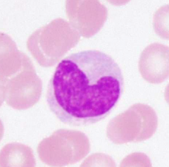 Globule blanc. Cellule située dans les vaisseaux sanguins capables de gagner les tissus en se transformant en macrophage. (noyau arqué)