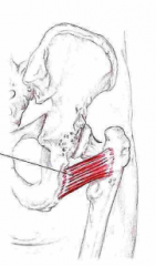 Udspring: Laterale kant af tuber ischiadicum
Insertion: Crista intertrochanterica (ml. trochanter major og minor)
Funktion: Lateral rotation af hoften 