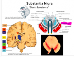 Substantia Nigra 
black because of pigments in the neurons in that region 
- important in motor control 
destroyed or damaged in parkinsons patients