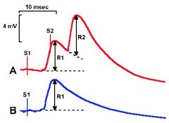 You record motor neuron response after two identical presynaptic impulses S1 and S2 are delivered 6 milliseconds apart (A).  The response (R1) to a single stimuli is given in B. Why is postsynaptic impulse R2 more than twice as large as response R...