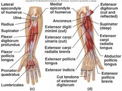 A muscle whose contraction bends a limb or other part of the body
