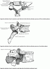 Cervical spine - Superior articular facet is anterior and inferior to the inferior articular process of the vertebra above. Nerve roots exit near the superior articulation

Thoracic spine - Superior articular facet is anterior and medial to the ...