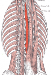 Origin: Common origin: Sacrum, iliac crest, and lumbar spinous process.

Insertion: T-spine: spinous process

Action: Laterally: Flex the head and neck to the same side. Bilaterally: Extend the vertebral column.

Innervation: Dorsal rami of ...