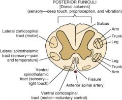 Sacral structures are the most peripheral in the lateral corticospinal tracts, cervical structures are more medial

Prognosis: 75% recover

Central cord syndrome: Weakness in UE>LE, sacral sensation spared. Common in elderly who fall, associat...