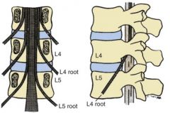 In the cervical spine, the numbered nerve exits at a level above the pedicle of the corresponding vertebral level (e.g., the C2 nerve exits at the level of vertebrae C1 to C2).

In the lumbar spine, the nerve root traverses the respective disc s...