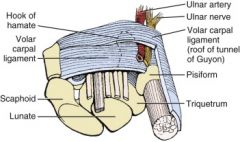 Transverse carpal ligament

It is attached medially to the pisiform and the hook of the hamate and laterally to the tuberosity of the scaphoid and the ridge of the trapezium