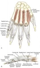 Attachment: Covers PIP joint 
Significance: Allows PIP extension (lumbrical muscles)