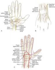 The ulnar artery. At the wrist, the ulnar artery lies on the TCL. It gives off a deep palmar branch (which anastomoses with the deep arch) and then forms the superficial palmar arch (which is distal to the deep arch).

Ulnar=sUperficial