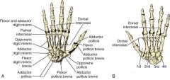 Origin: TCL, palmar aponeurosis	
Insertion: Ulnar palm	
Action: Retracting skin	
Innervation: Ulnar nerve