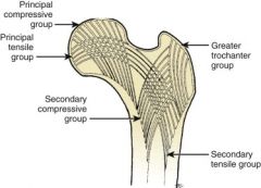 Trabecular patterns help determine the presence of osteopenia and displacement of femoral neck fractures