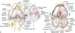 Which meniscus tears more often and why?