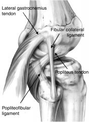There are 6 structures:
1. LCL*
2. Popliteus tendon*
3. Popliteofibular ligament*
4. Arcuate ligament
5. Posterolateral capsule
6. Lateral head of the gastroc