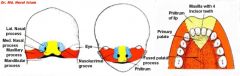 Intermaxillary segment

Develops into the nasal tip, columella, central upper lip/philtrum, and (includes central maxillary alveolar ridge, maxillary incisors, and the hard palate anterior to the incisive foramen)