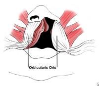 Dehiscence of the orbicularis oris with abnormal attachments to the alar base & columella