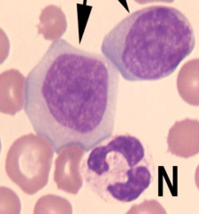 Identify the cells indicated by the arrows.
What are some characteristics that distinguish them?
