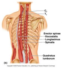 deep muscle of back.  3 colums extends from sacrum to ribs.  Extends vertebral column
