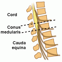 Bundet af nerverødder som findes caudalt for medulla spinalis på deres vej ud mod de resp. foramina intervertebralia.


Består altså af de parrede dorsale og ventrale nerverødder fra L2 til halesegmentet.