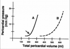 *Pericardium is relatively stiff.

*Symptoms of cardiac compression are dependant on:
	1. Volume of fluid.
	2. Rate of fluid accumulation.
	3. Compliance characteristics of the pericardium.

Graphs:
A. Sudden increase of small amount of fl...