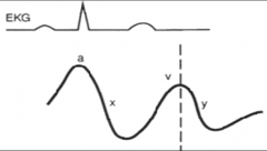 (1) A-wave:
1) results from ATRIAL contraction. 
2) Timing - PRESYSTOLIC. 
3) Peak of the a-wave near S1.

(2) V-wave:
1) results from PASSIVE filling of the right atrium while the tricuspid valve is closed during ventricular systole (Reme...