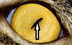 Identify this part of the eye.