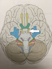 Identify this cranial nerve.