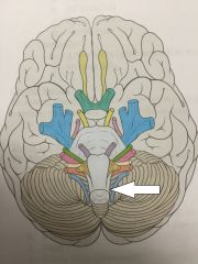 Identify this cranial nerve.