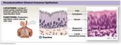 Located: lining of nasal cavity and trachea


 


*look for cilia