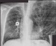 Take a look at the x-ray. What is your diagnosis? What are the abnormalities?