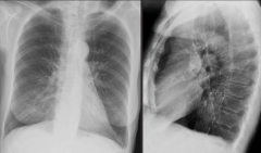 Take a look at the x-rays. What is your diagnosis? What are the abnormalities?

not exact matches on x-ray