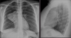 Take a look at the x-ray. What is your diagnosis? What are the abnormalities?