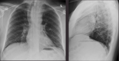 Take a look at the x-ray. What is the diagnosis? What are the abnormalities?