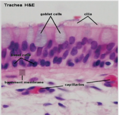 "Ciliated cells
Goblet cells (secrete mucus)
Basal, serous cells
Basement membrane"
