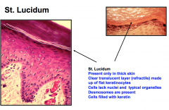 St. Lucidum

Seen
in thick skin 

-lose
nuclei and organelles 

-fill with keratin.