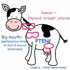 Cowden disease - AUT DOM

Mutation in PTEN gene, phosphatase/tensin gene which is involved in cell cycle control 

Cancer: thyroid, breast & uterus 
Papillomas, hamartomas 
Risk of breast cancer 25-50% 
Risk of endometrial 5-10%

PRLG #1 
CO ...