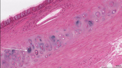 Which layer of the trachea is indicated by the white arrow?  What is it composed of?