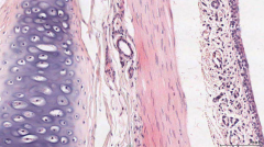 "The lining epithelium (of the mucosa layer).

It consists of pseudostratified columnar epithelium, composed of ciliated lining cells and goblet (secreting) cells. (also, other epithelial cell types)"