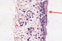 What is the function of the cilia lining the bronchus?