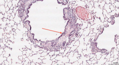 What layer of the bronchiole is indicated by the red arrow?
